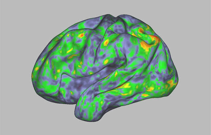 Psilocybin for Anorexia: A Promising but Unproven ‘Reset’ for the Brain